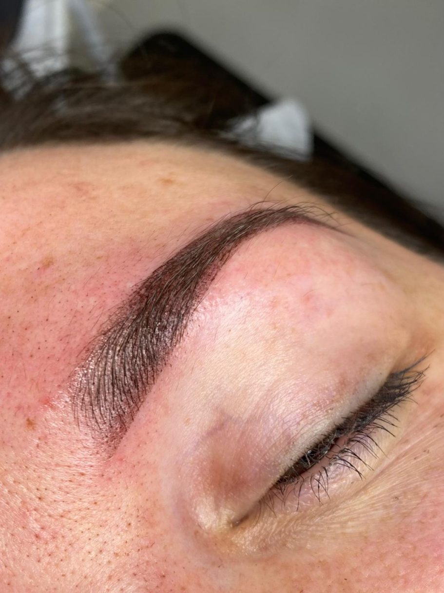 Direct na de behandeling