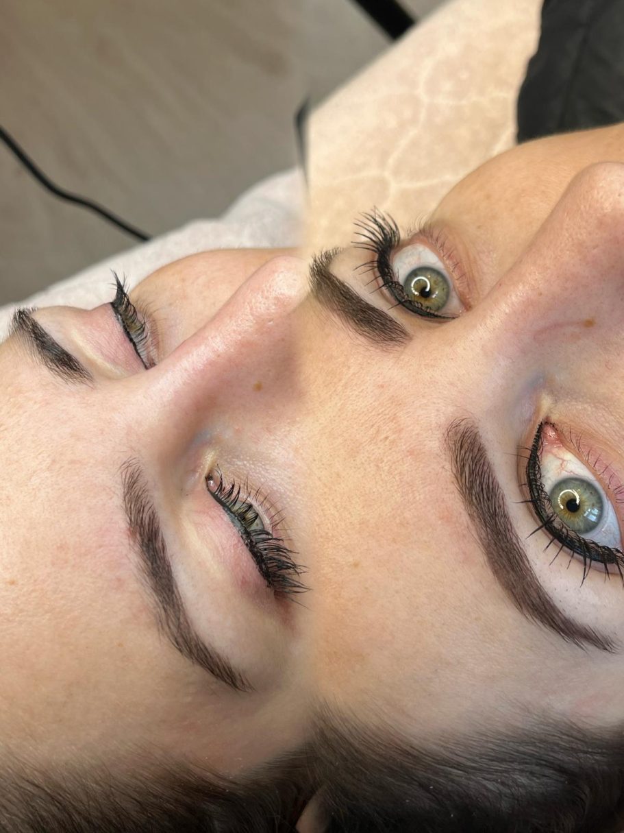 Voor en genezen na de 1e behandeling